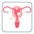 Fibroid Embolization